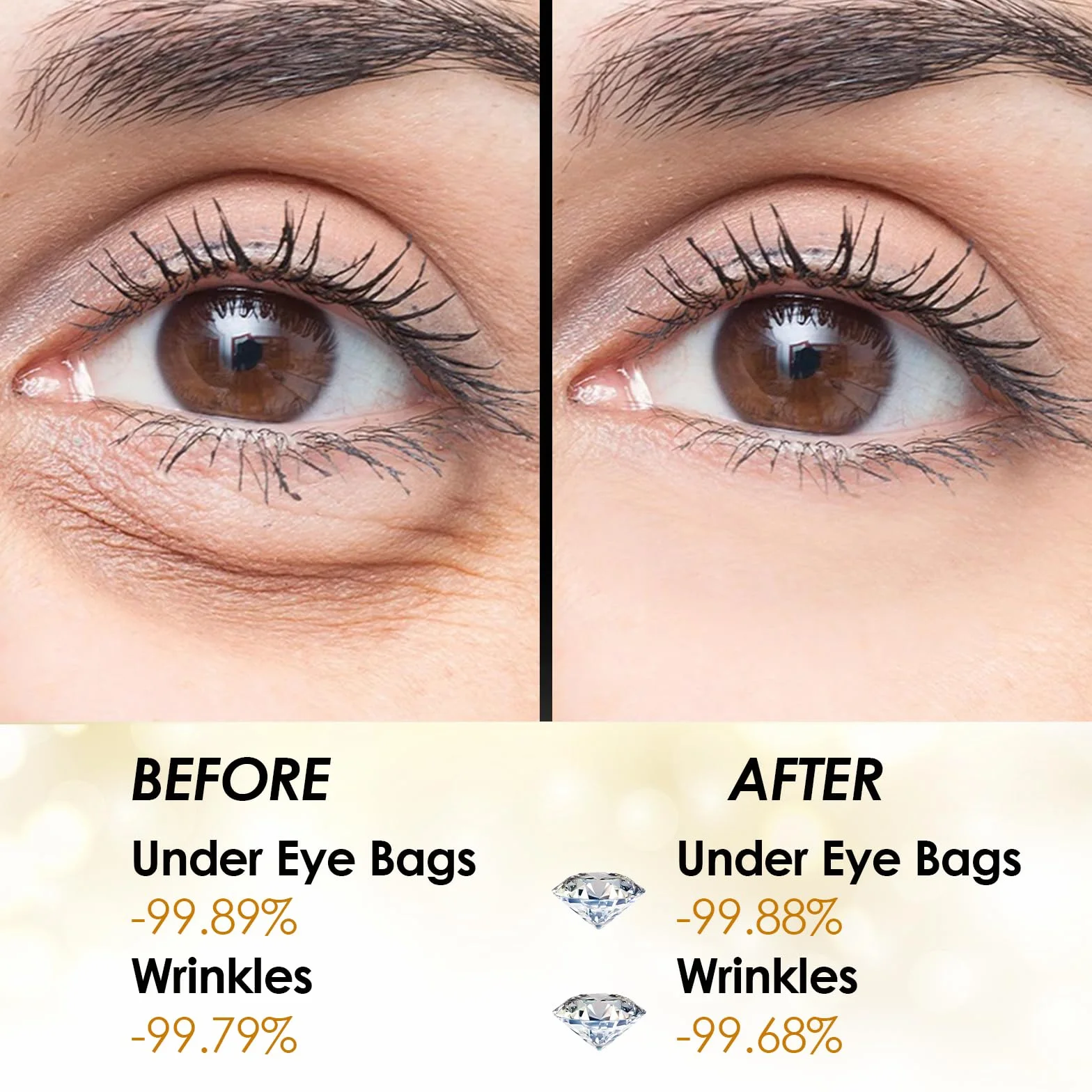 Patch Anti Cernes Yeux 60 Patch Gold Masque Contour des Yeux Hydratant