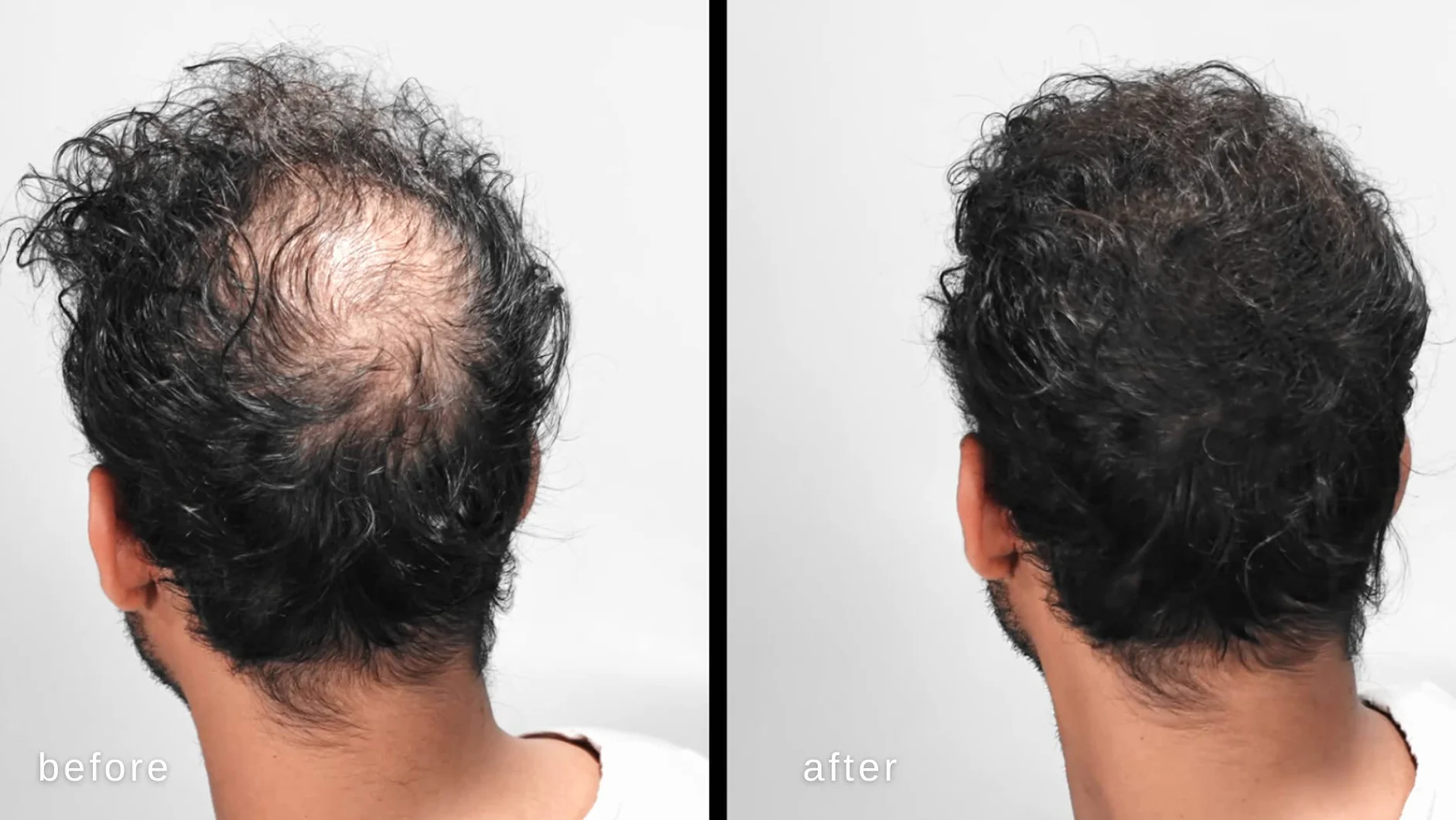 Hypoallergénique fibres épaississantes cheveux Marron foncé testé dermatologues