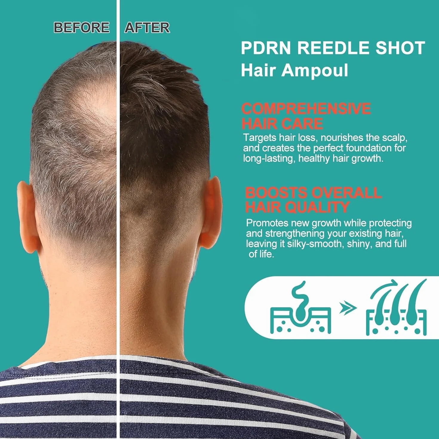 Sérum capillaire anti-chute pour cuir chevelu, nourrit et fortifie les racines