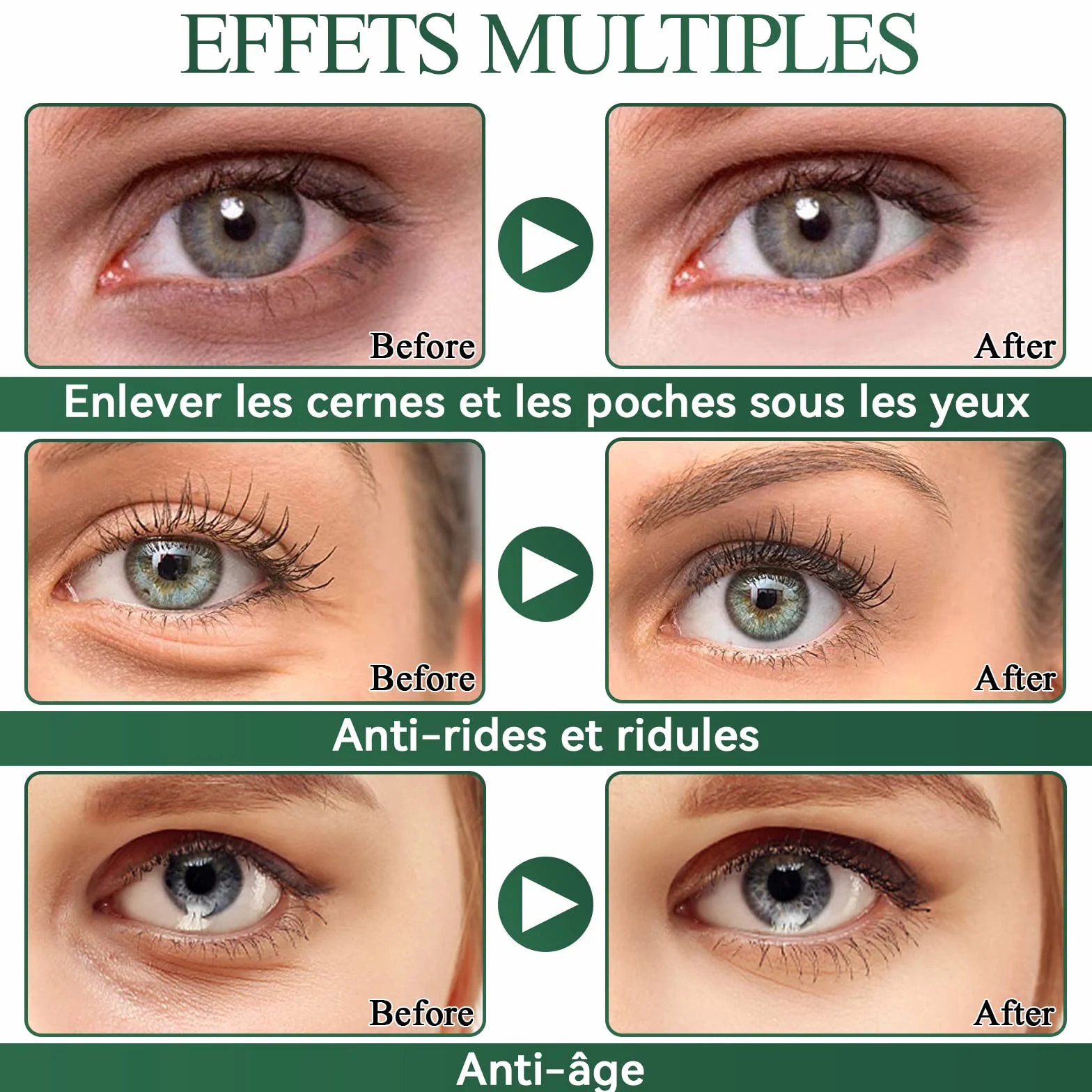 Eveellyn Patch Yeux Anti Cernes Hydratant Anti-âge à L'aloe Vera, 60 pièces