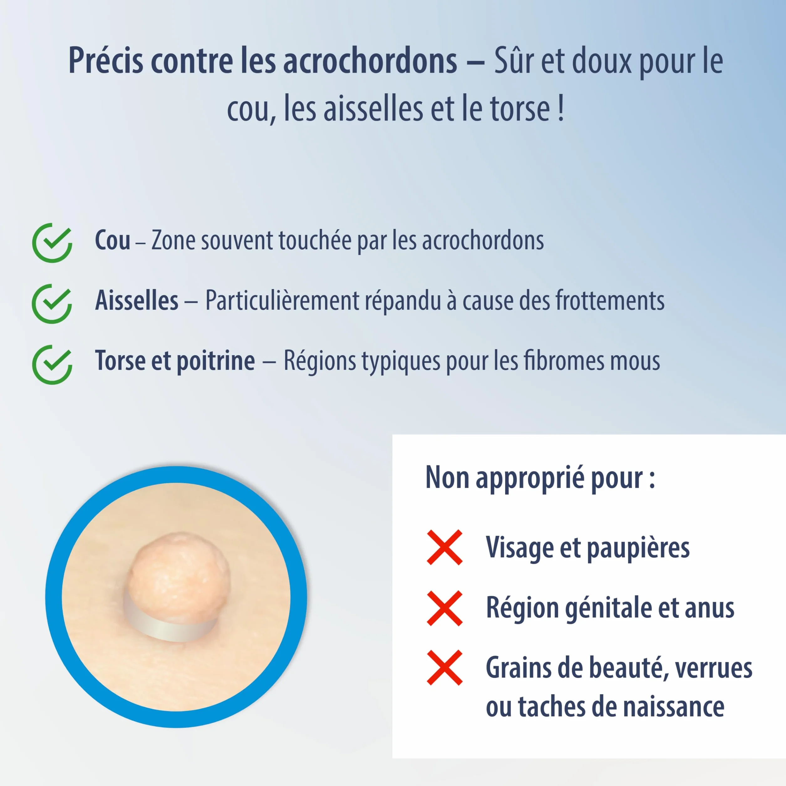 Evolsin Anti acrochordon - Efficace contre les verrues pédiculaires - Idéal pour le cou, les aisselles et le corps