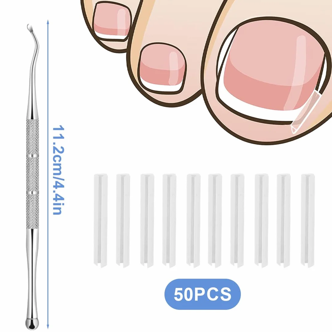 Kit correcteur d'ongles incarnés 50 bandes de redressement avec lève-ongles