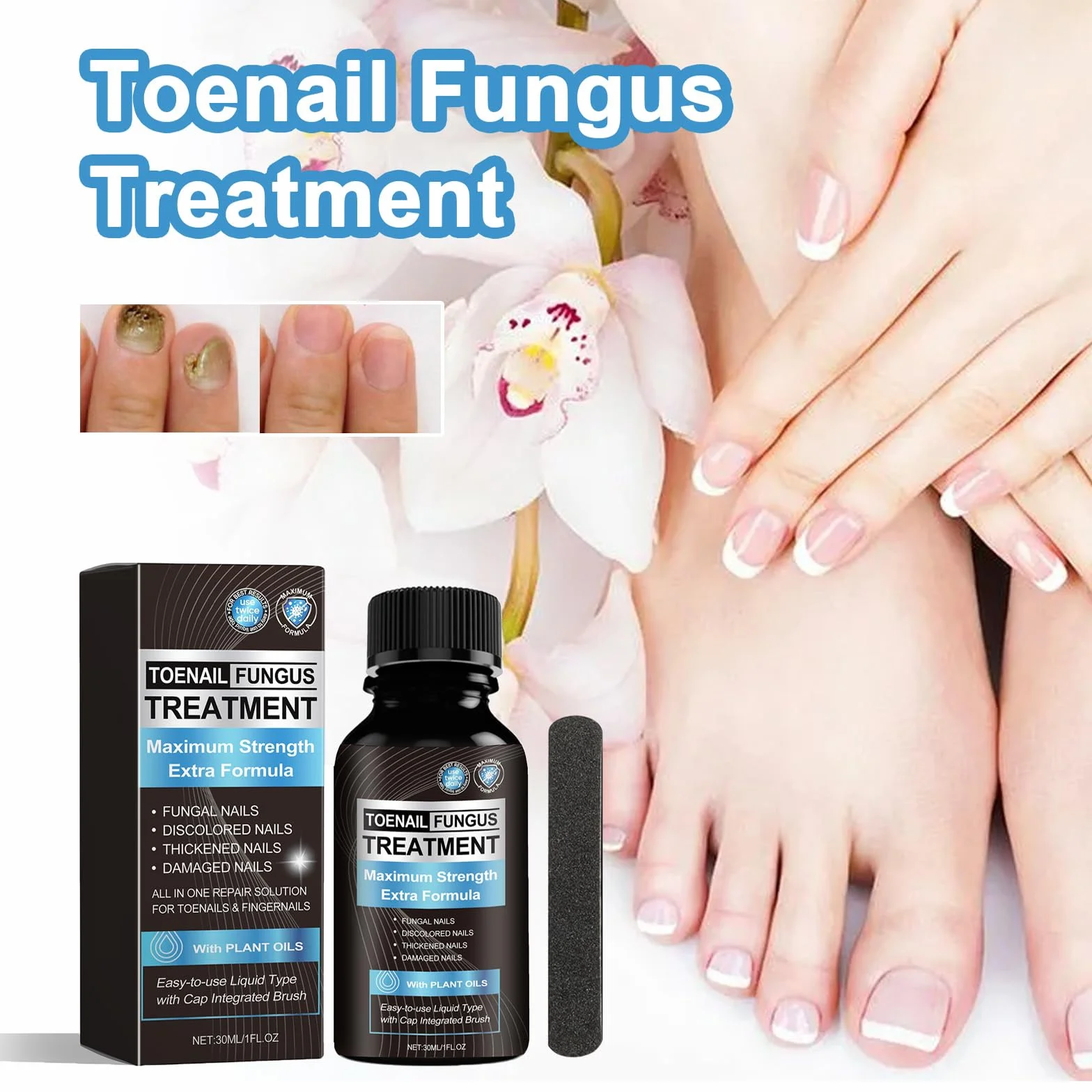 Toenail Fungus Treatment Extra Strength 30ML Nail Fungus Treatment for Damaged Nails
