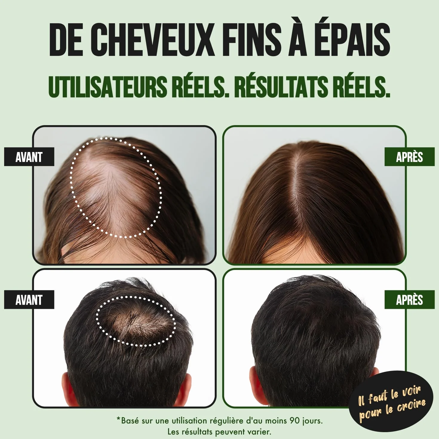 Serum Pousse Cheveux Spray à la Biotine, Caféine, Huile de Ricin et Aminexil - Favorise la Pousse Rapide (3 mois)