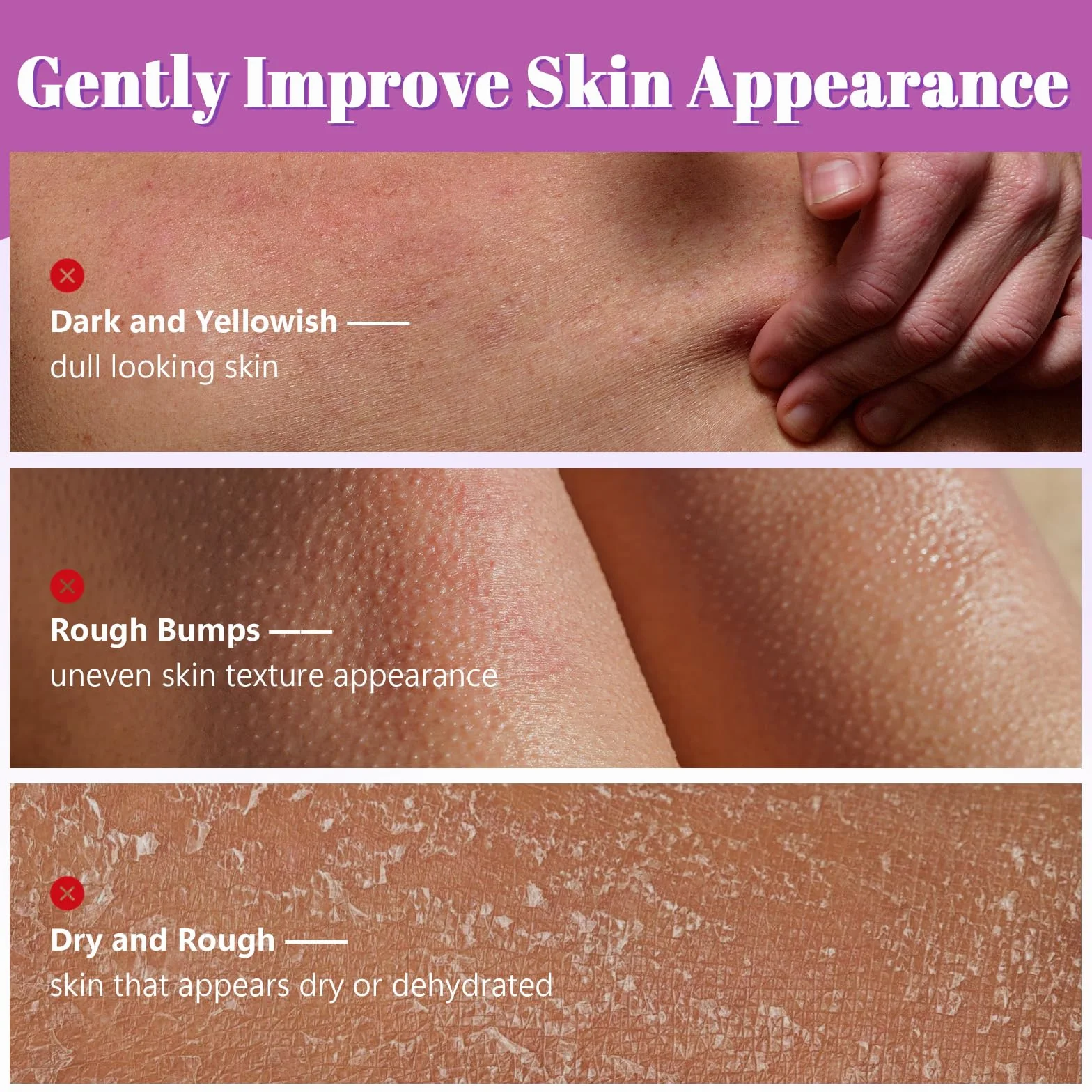 Bâton Exfoliant Corps Acide Glycolique 75 G 7% Acide Glycolique 0,5% Acide Salicylique AHA BHA