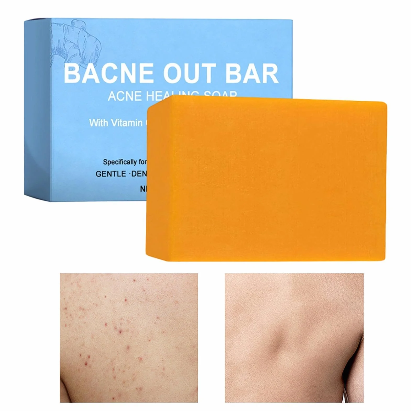 Bacne Out Bar Soap with Turmeric Brightening Body Wash Natural Clean Soap Bar