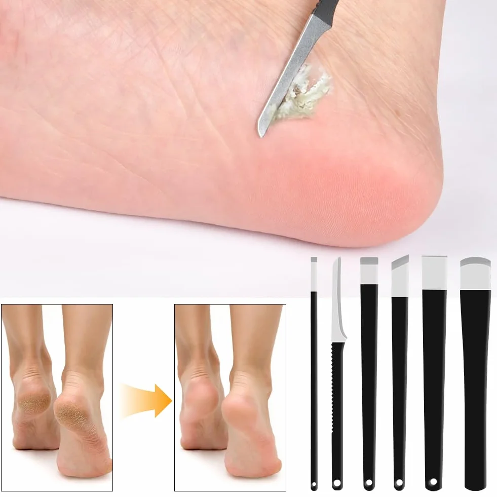 LOPHE Ensemble de 6 pièces Pédicure Outils, Kit Couteau Pédicure avec Lime en Acier Inoxydable