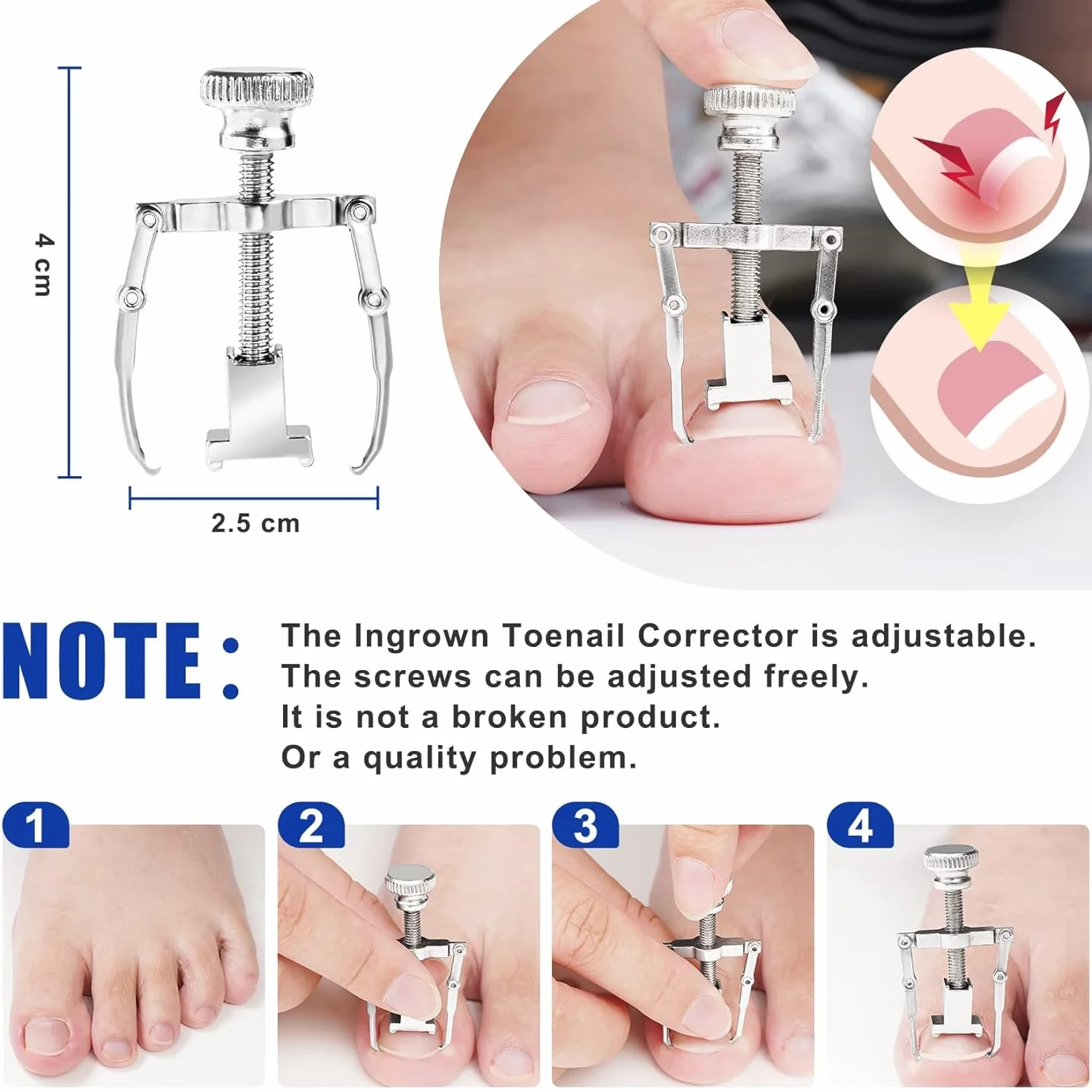 Kit de Traitement des Ongles Incarnés – Pince à Ongles Incarnés et Outils de Correction en Acier Inoxydable