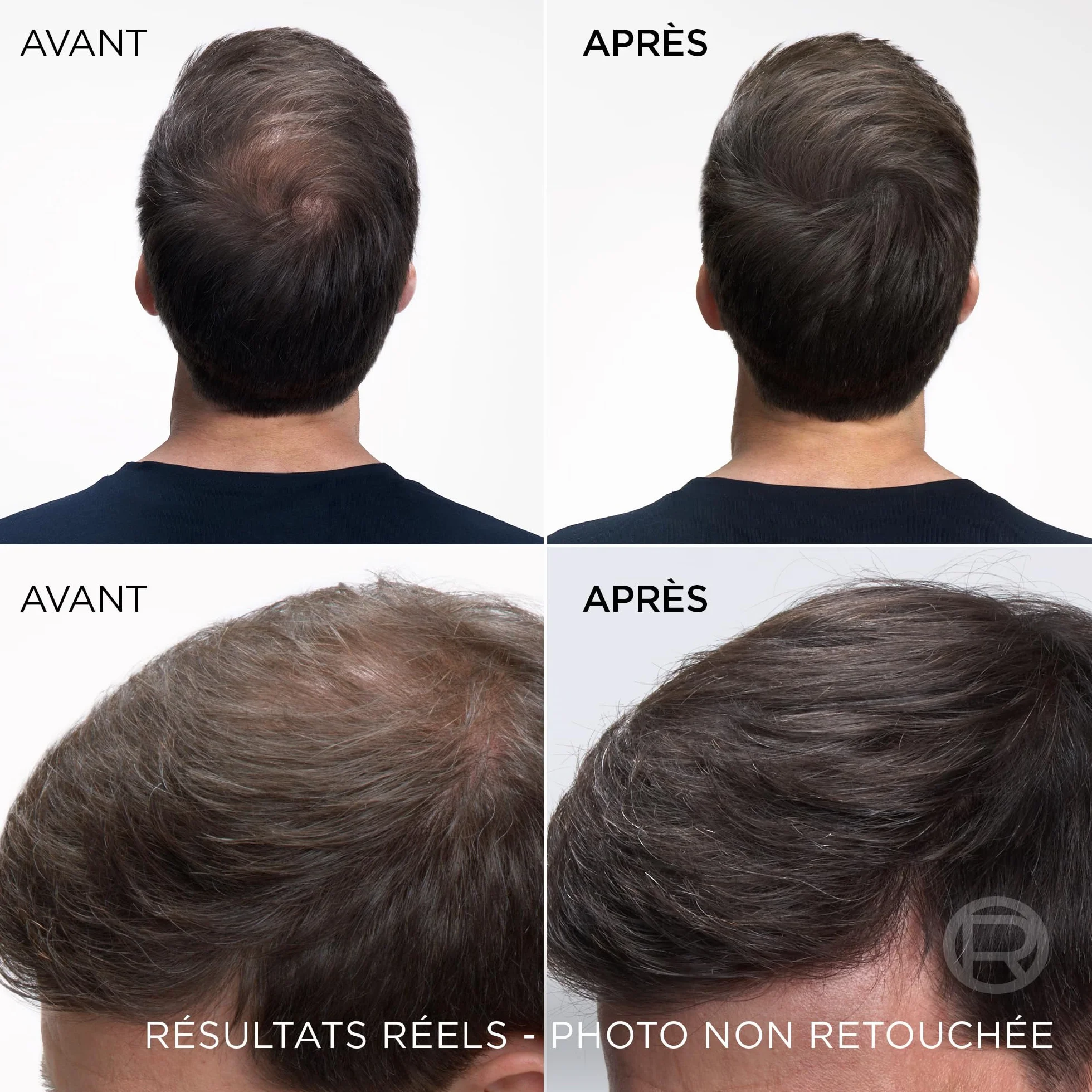 L’ORÉAL PARIS Magic Retouch Spray Instantané Correcteur de Racines & Cheveux Blancs, Châtain Foncé, 2x75ml