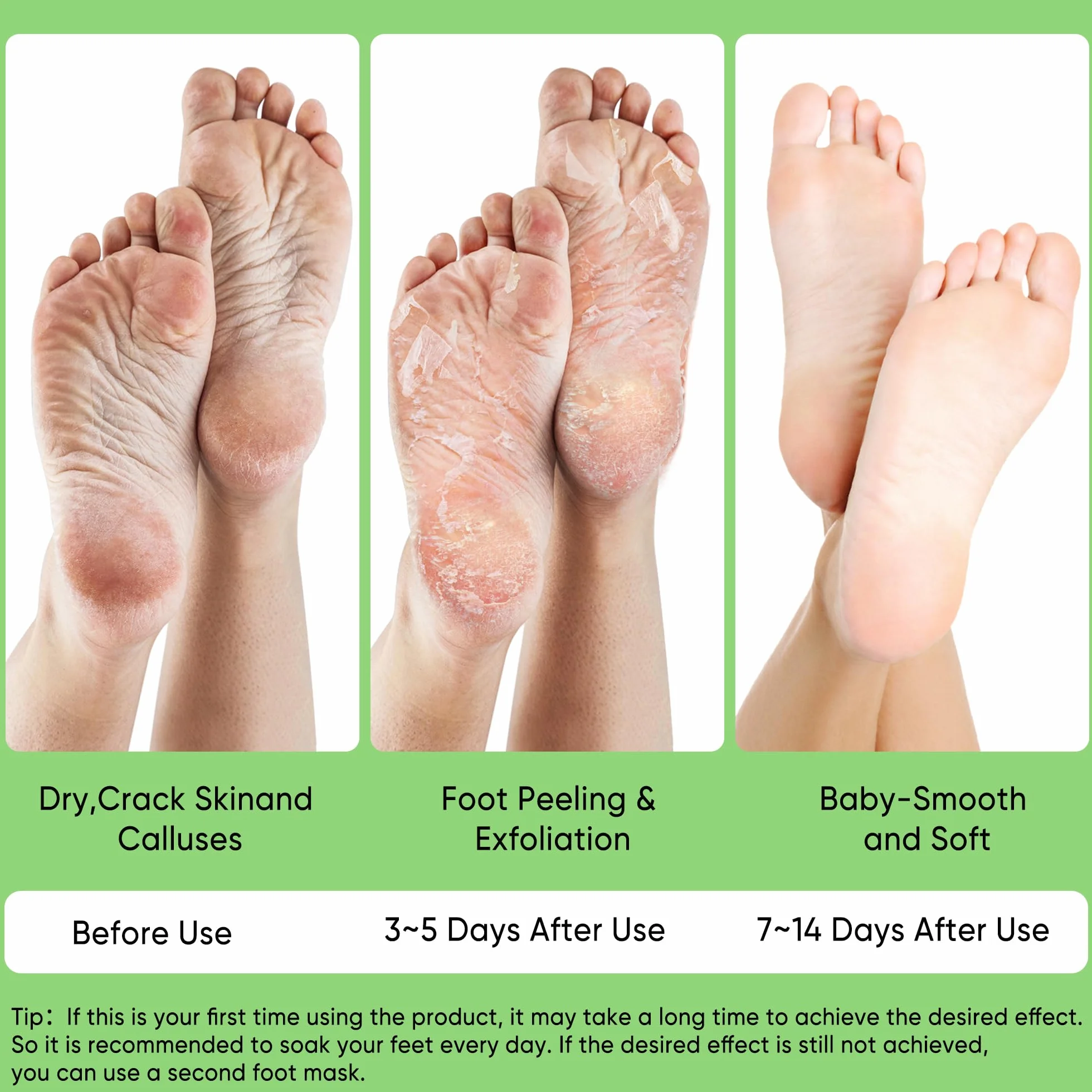 Masque Pieds Exfoliant 3 Paires Aloe Vera Soin Pieds Secs Talons Fendus Callosités Peau Morte