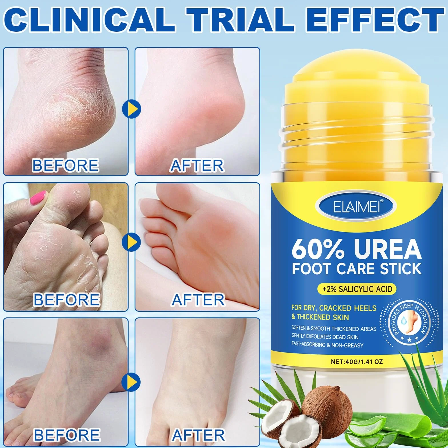 Bâton Réparateur Pieds Urée 60% Acide Salicylique 2% Soin Intensif Talons Fendillés Peau Très Sèche Stick Hydratant Absorption Rapide