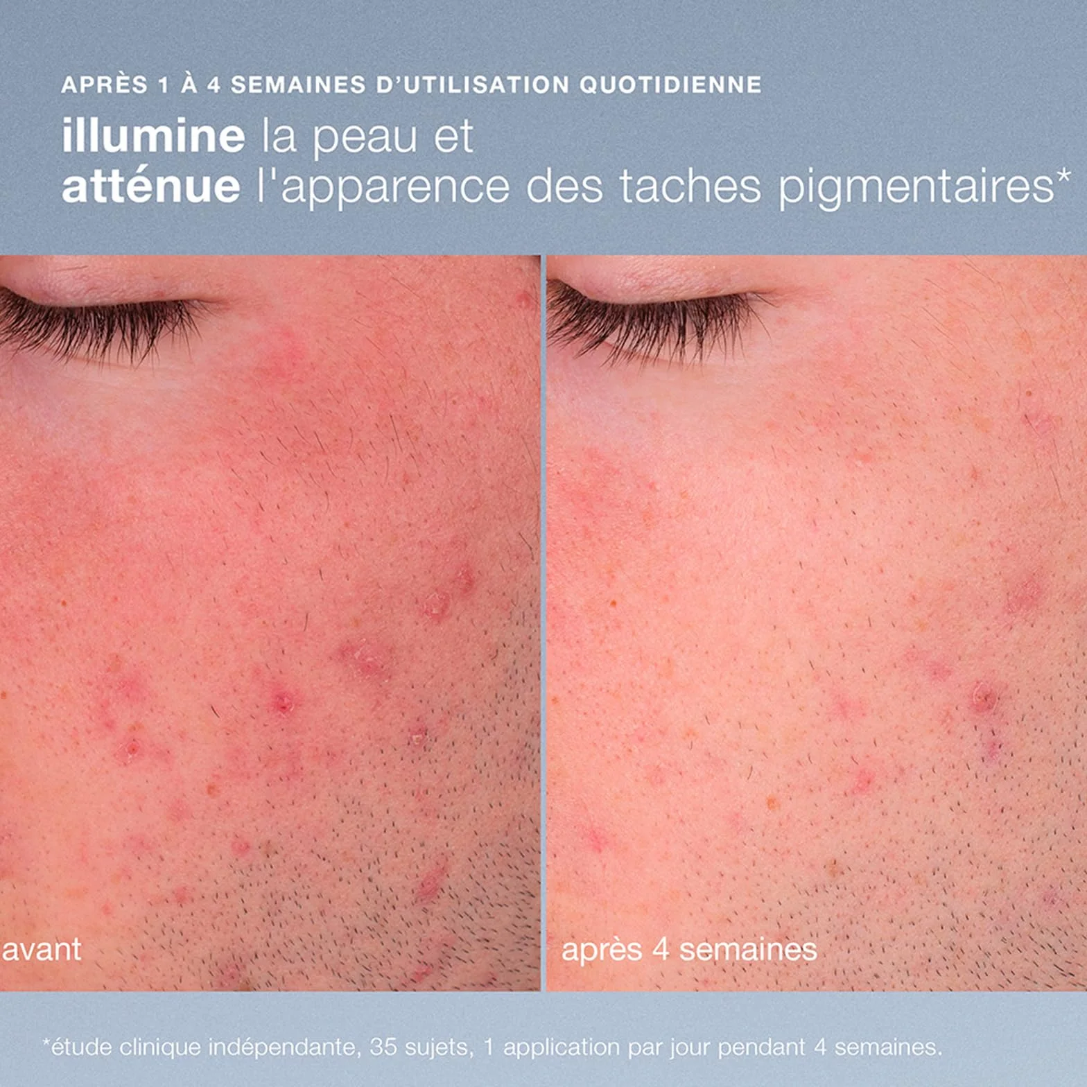 Dermalogica Daily Microfoliant - Exfoliant doux iconique à la poudre de riz pour lisser et illuminer le teint