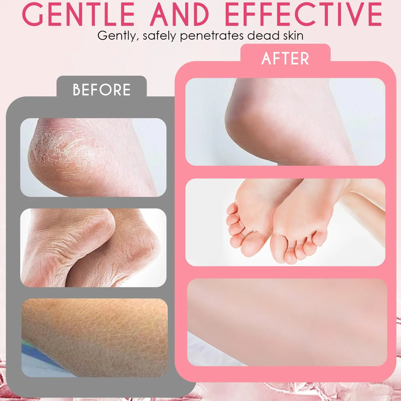 Masque Pied Peeling, Hornhaut Entfernung Fuß Peeling Maske, Hydratant, Nourrissant Pieds, Soin Réparateur (strawberry + papaya)