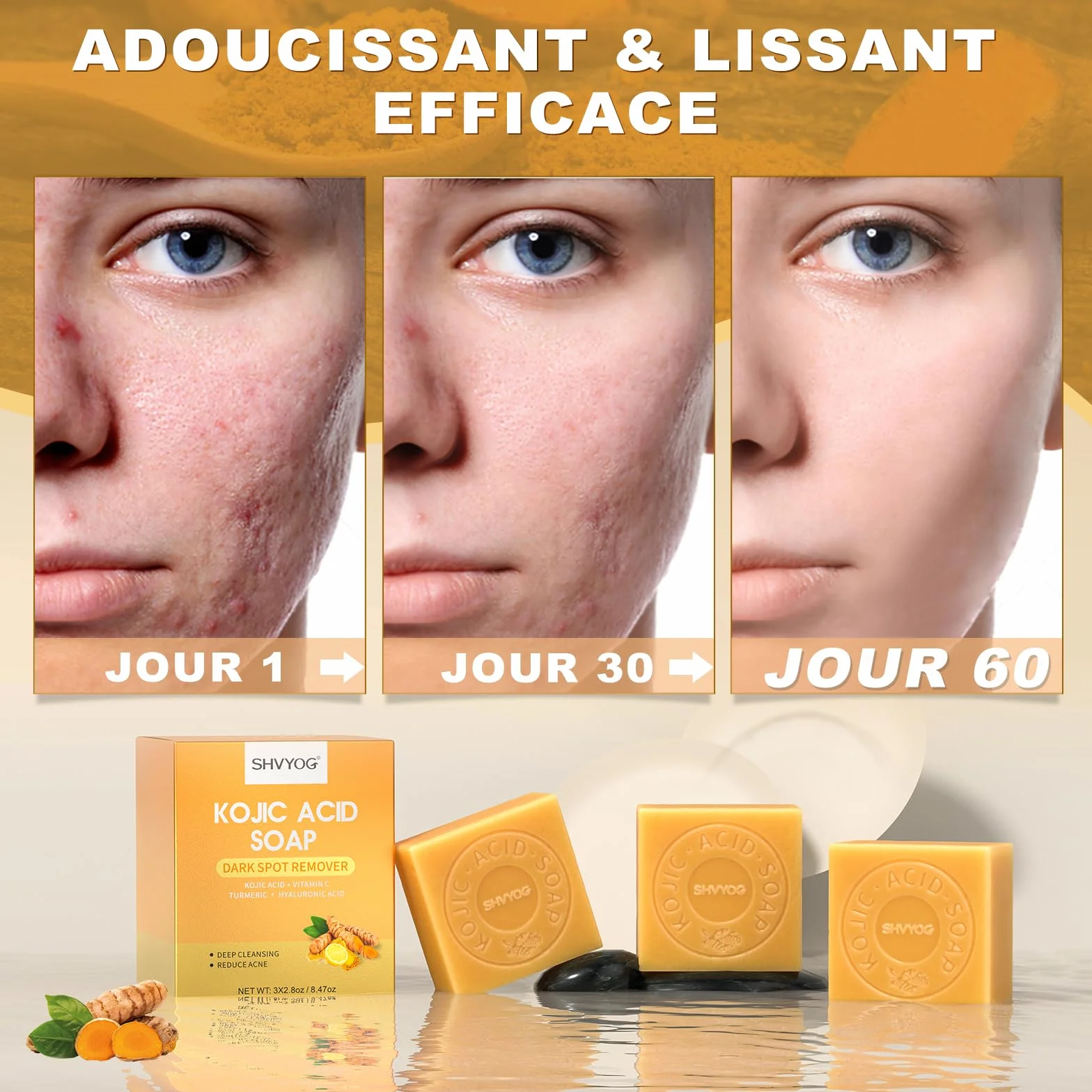 Savon à l'Acide Kojique et Curcuma, Savonnette 3x80g pour Points Noirs, Acné et Taches Foncées