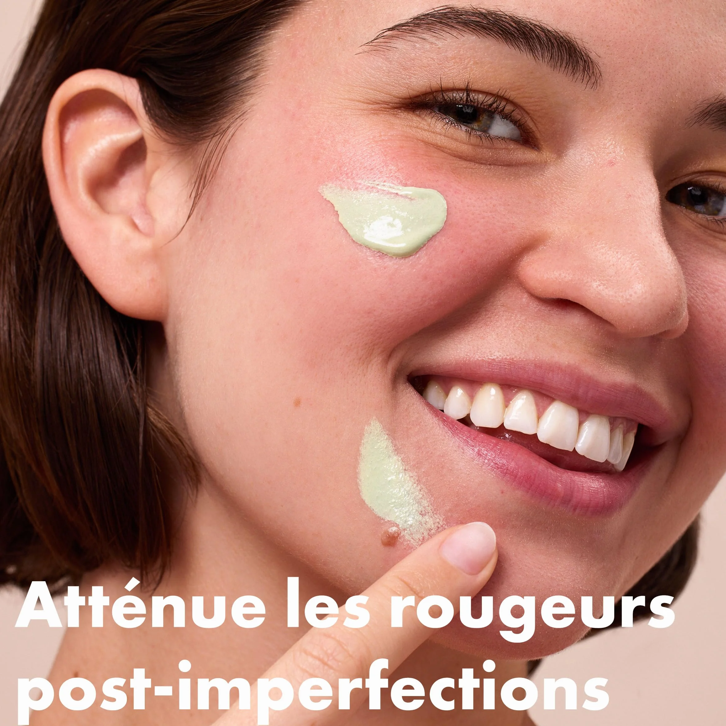 Hero Cosmetics Rescue Balm Red Correct Baume Correcteur Anti-Rougeurs Atténue les rougeurs 15 mL