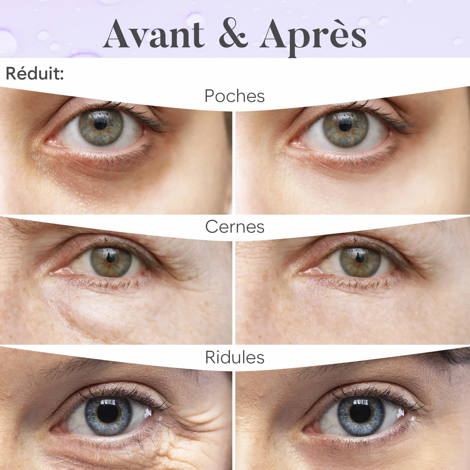 Patch Yeux Anti Cernes Caféine Collagène Acide Hyaluronique 30 Paires Hydratation Poches