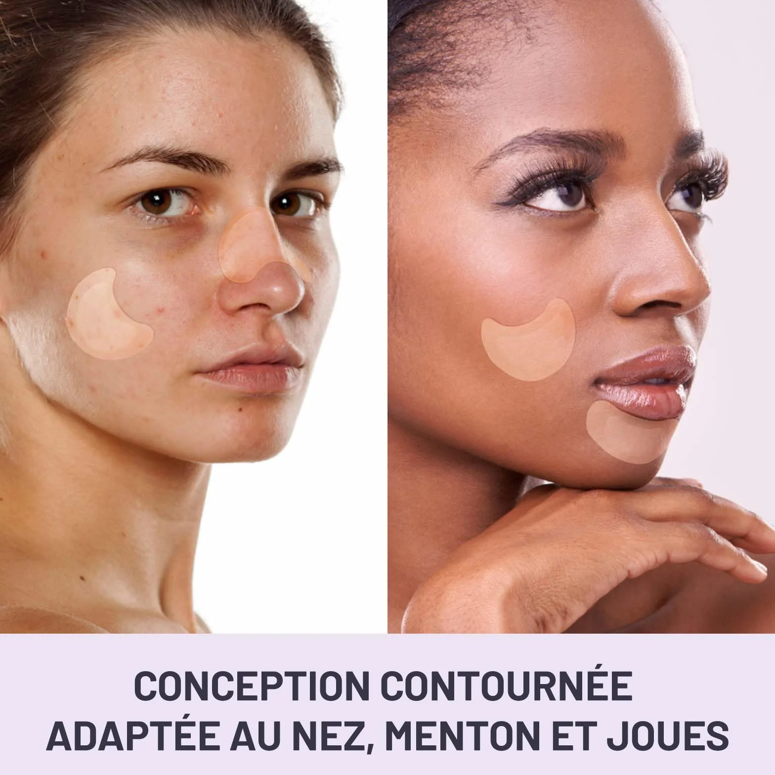 Patchs bouton ACOTYE 32pcs, pimple patch à l'huile d'arbre à thé, acide salicylique et niacinamide