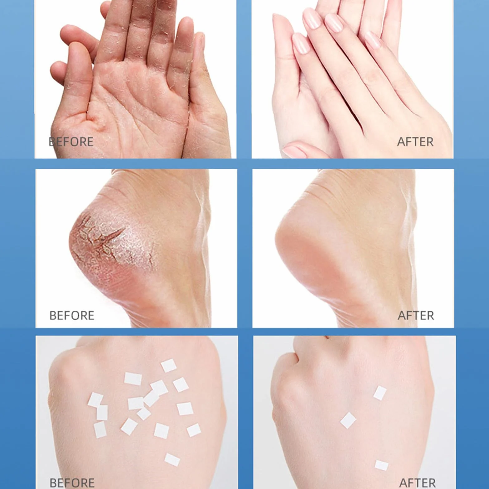 Crème pour les Pieds Hydratant Exfoliant Anti-Crevasses Guérir Pommade Peau d'Hiver