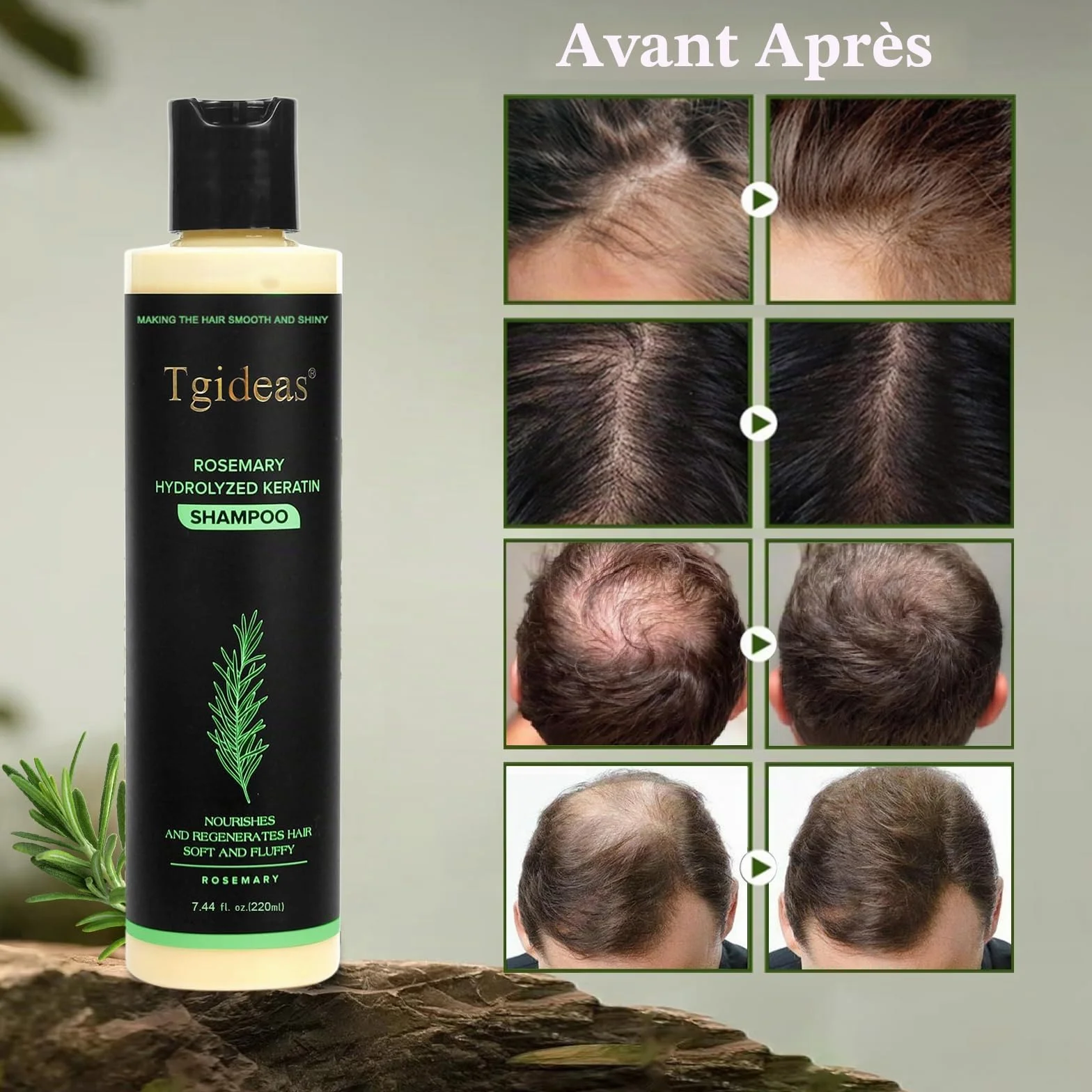 Tgideas Shampoo Bio Croissance Cheveux Sauge Romarin Renforcer Épaissir Kératine Hydrolysée Cheveux Fins Chute