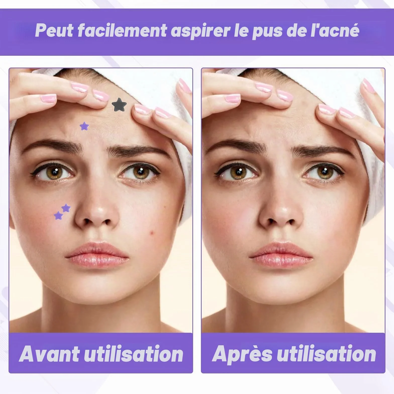 Pimple Patches 408 pièces Hydrocolloïde Acné Patch Invisible avec Huile de Tea Tree et Acide Salicylique