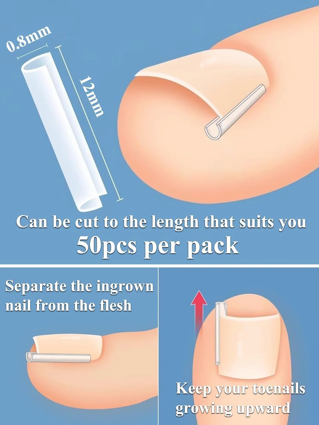 Kit de Traitement des Ongles Incarnés – Pince à Ongles Incarnés et Outils de Correction en Acier Inoxydable
